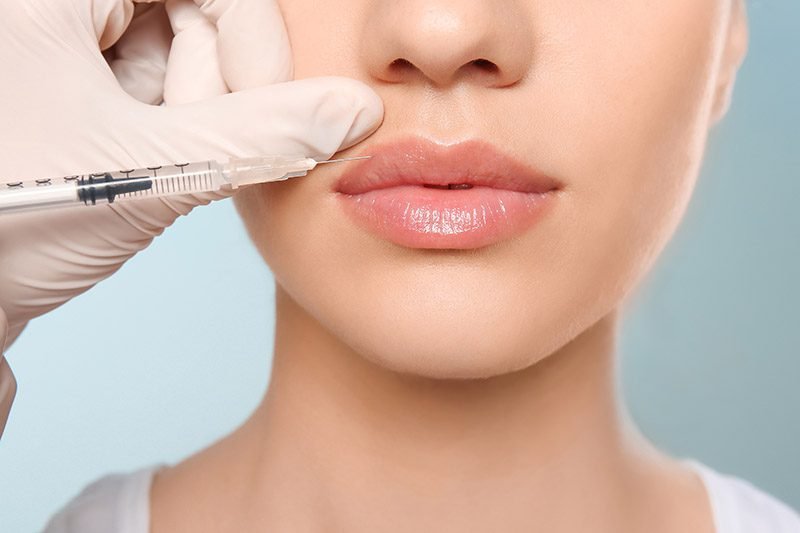 Dermal fillers lip and cheek enhancement