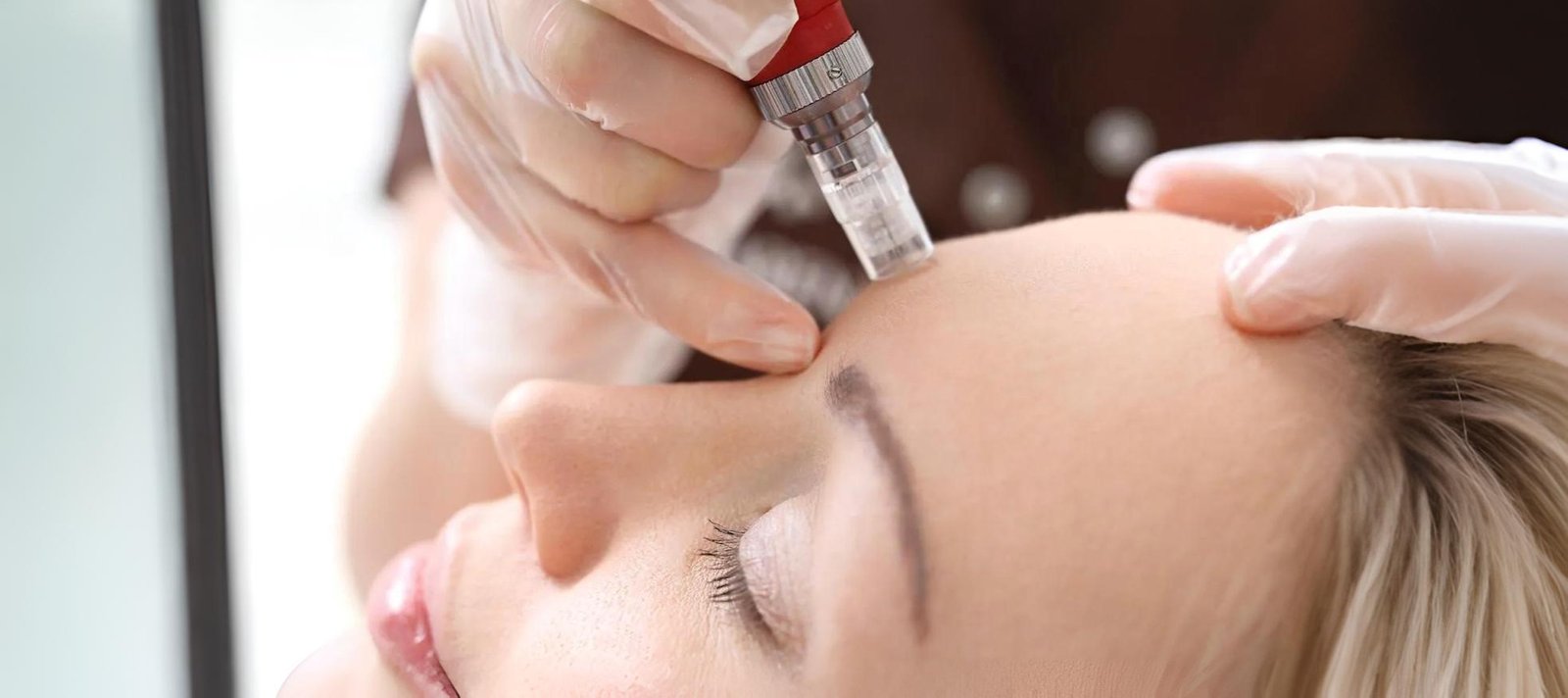 Mesotherapy Nutrient Delivery