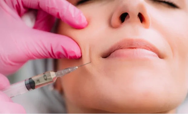 Dermal fillers lip and cheek enhancement